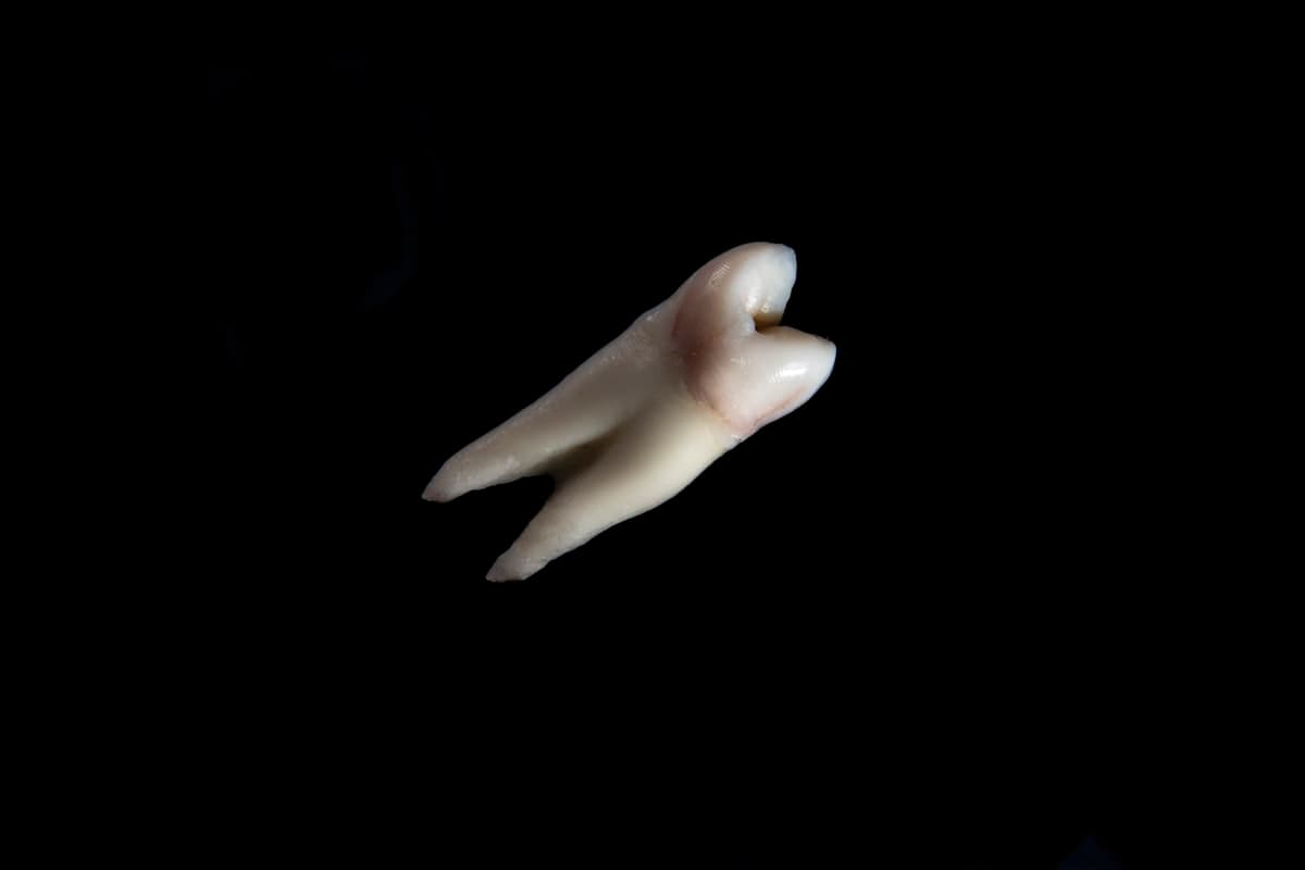 Apneia do sono e o papel do dentista