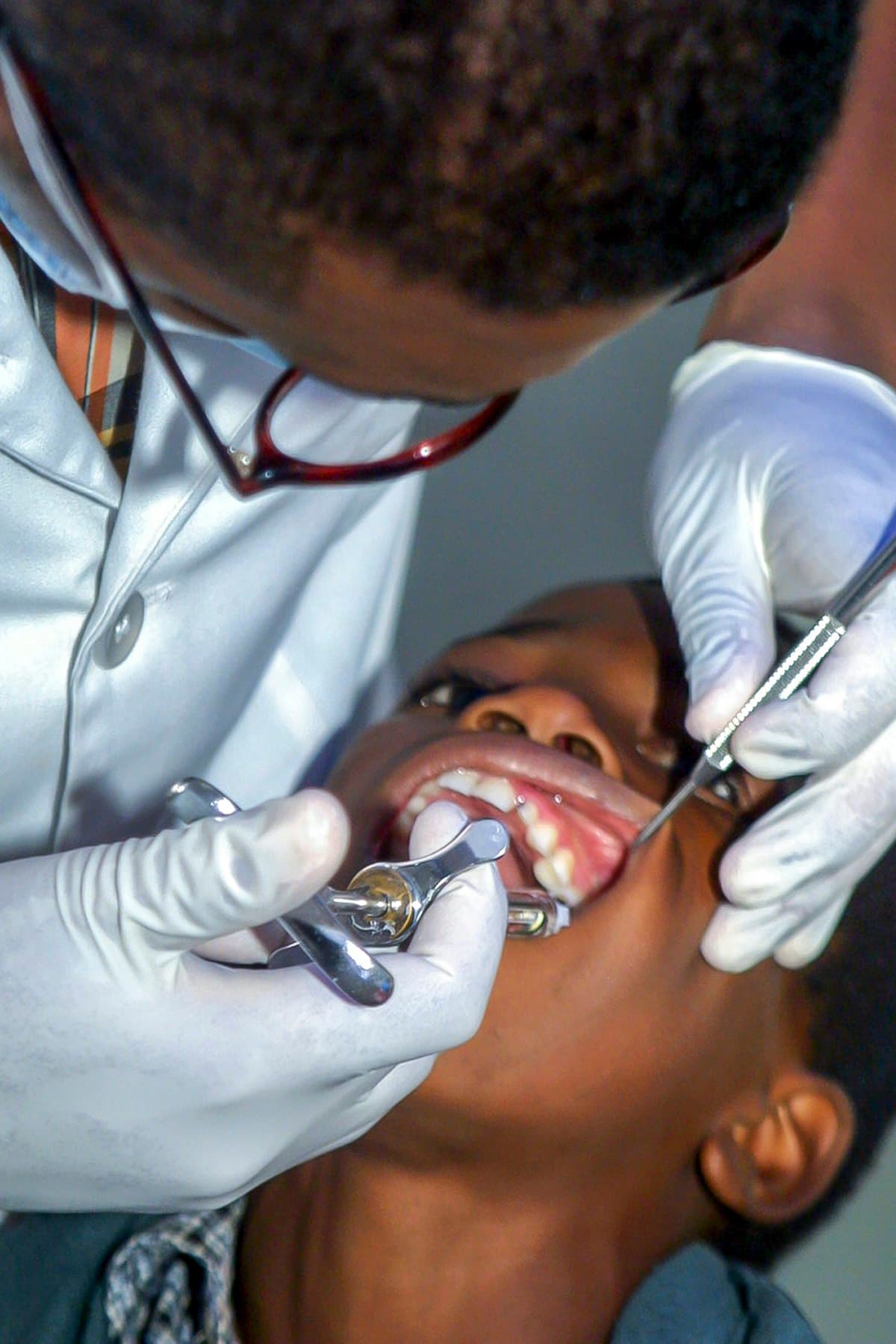 Criança bateu o dente: o que fazer (passo a passo)