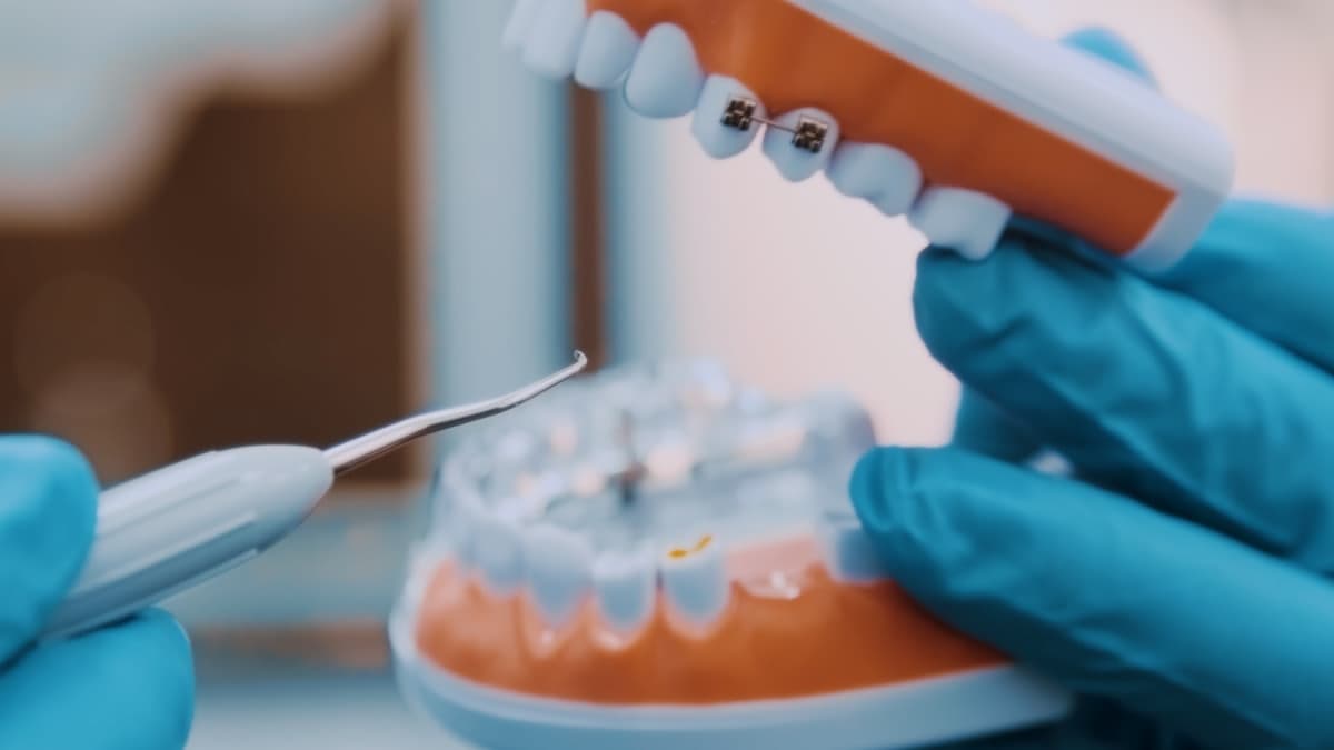 Dentadura nova: como se acostumar nas primeiras semanas
