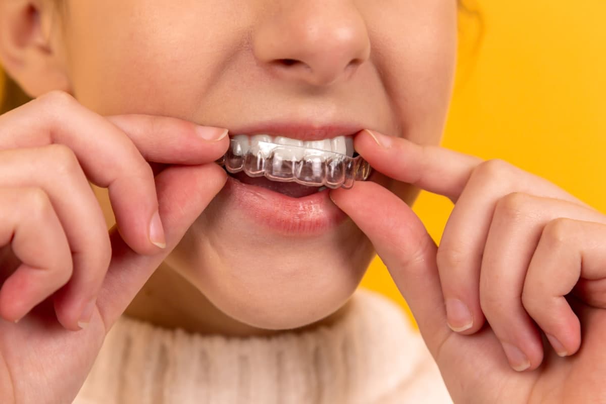 Dentista indicou aparelho — preciso mesmo?