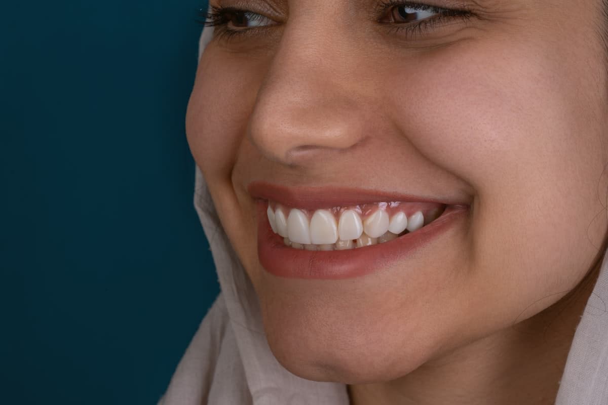 Design de sorriso: como é o planejamento