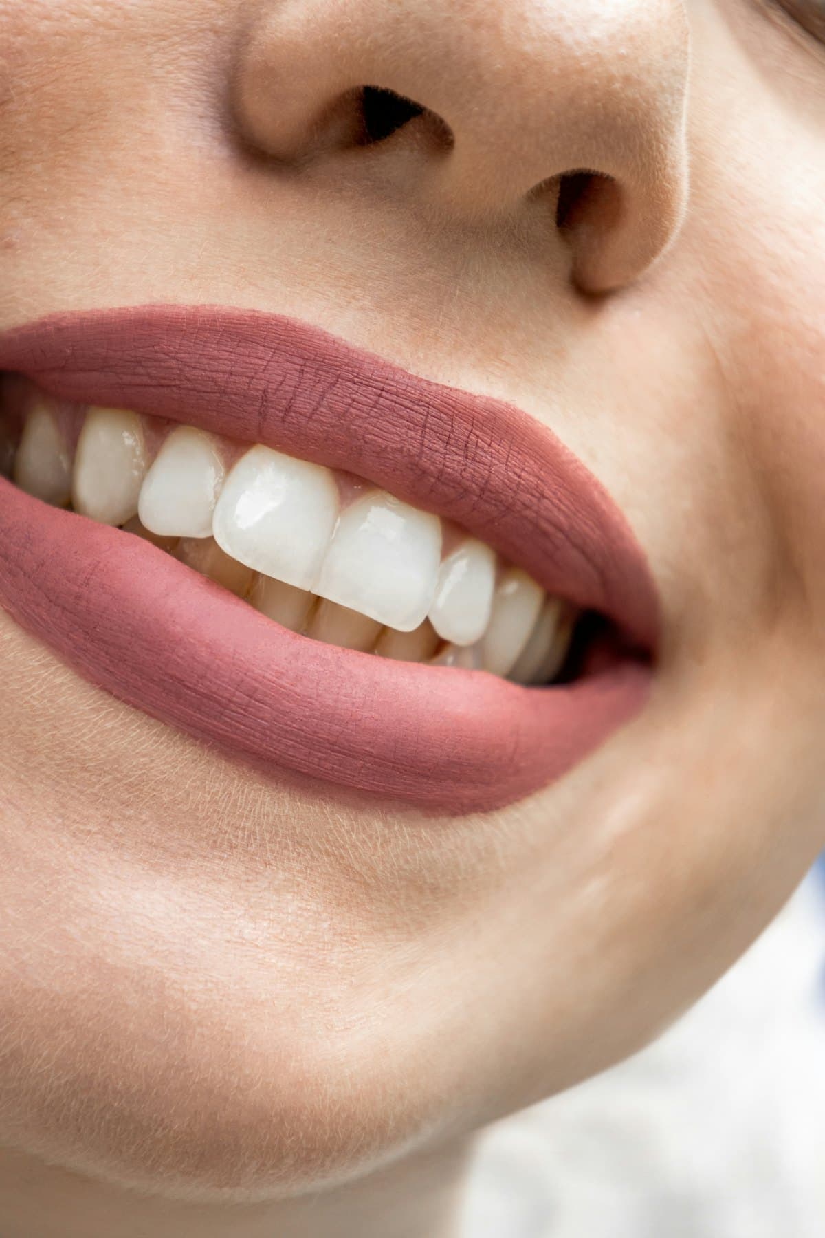 Facetas: resina ou porcelana? Diferenças, prós e contras