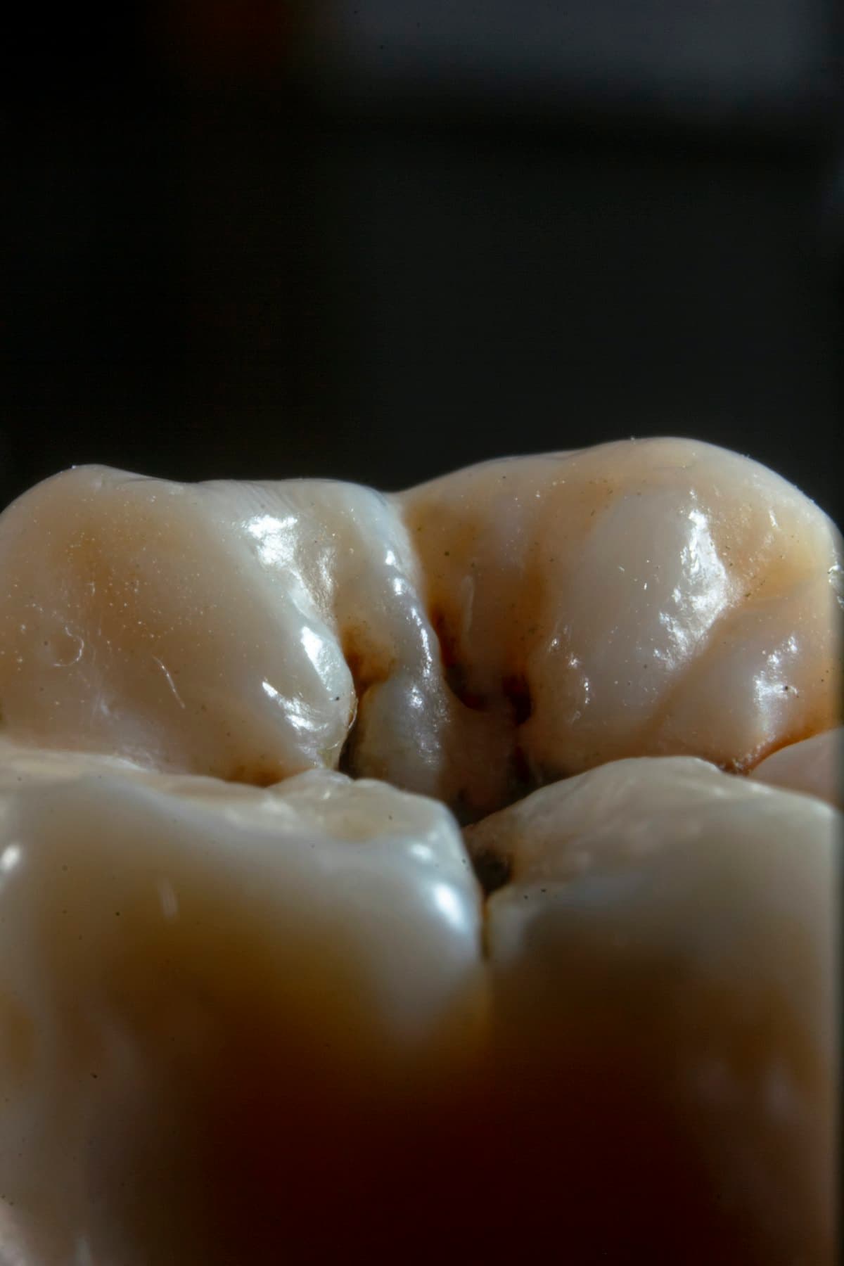 Hipertensão e tratamento dental: o que muda