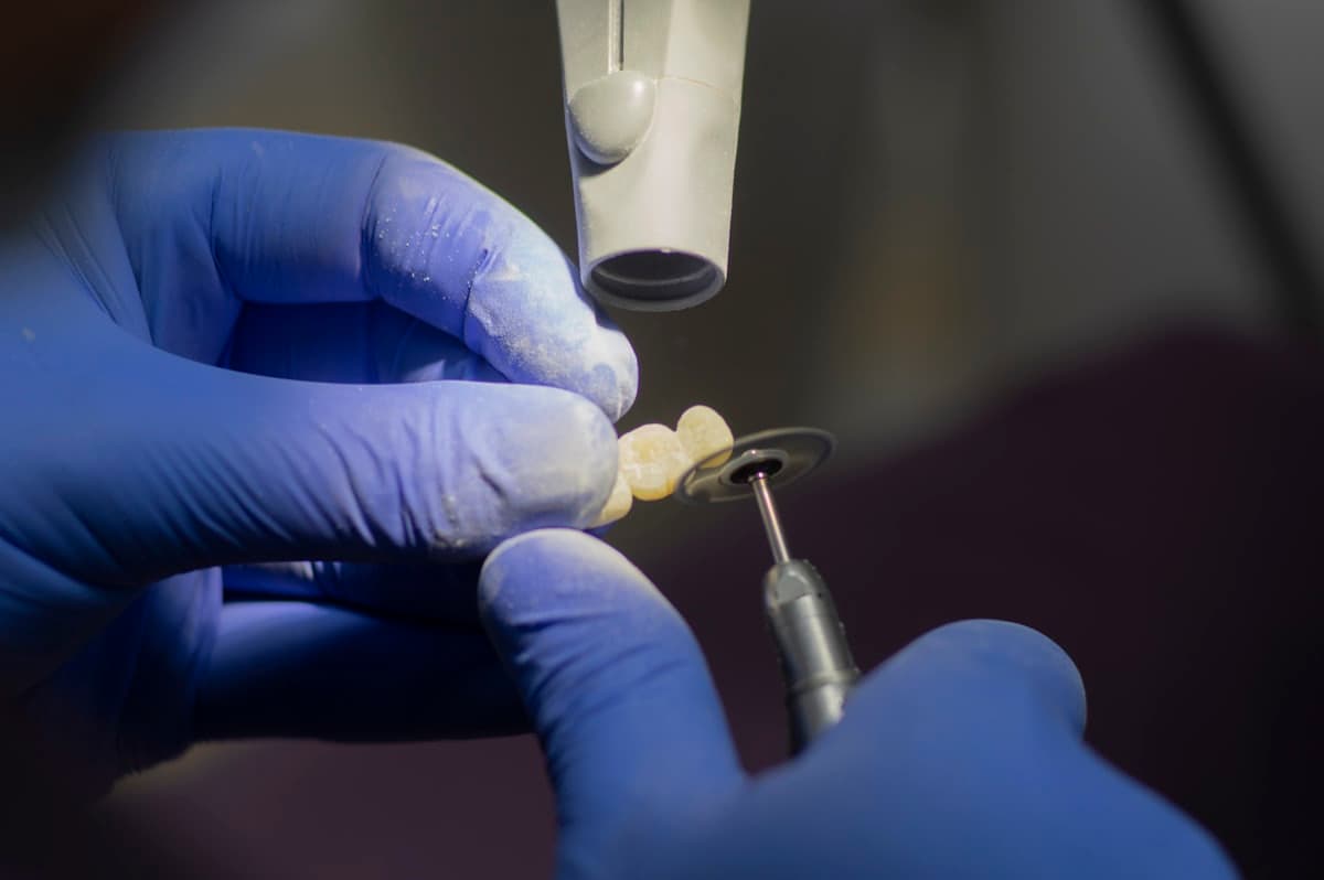 Implante dental em Crato e Cariri