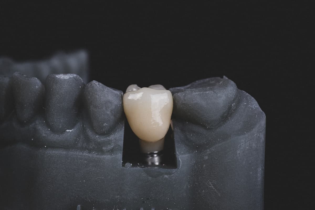 Prótese dentária em Juazeiro: como escolher onde fazer
