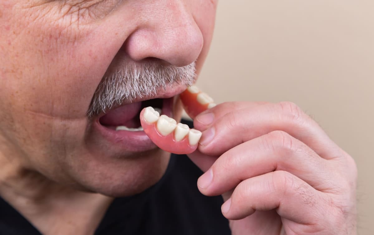 Quanto custa uma prótese dentária?