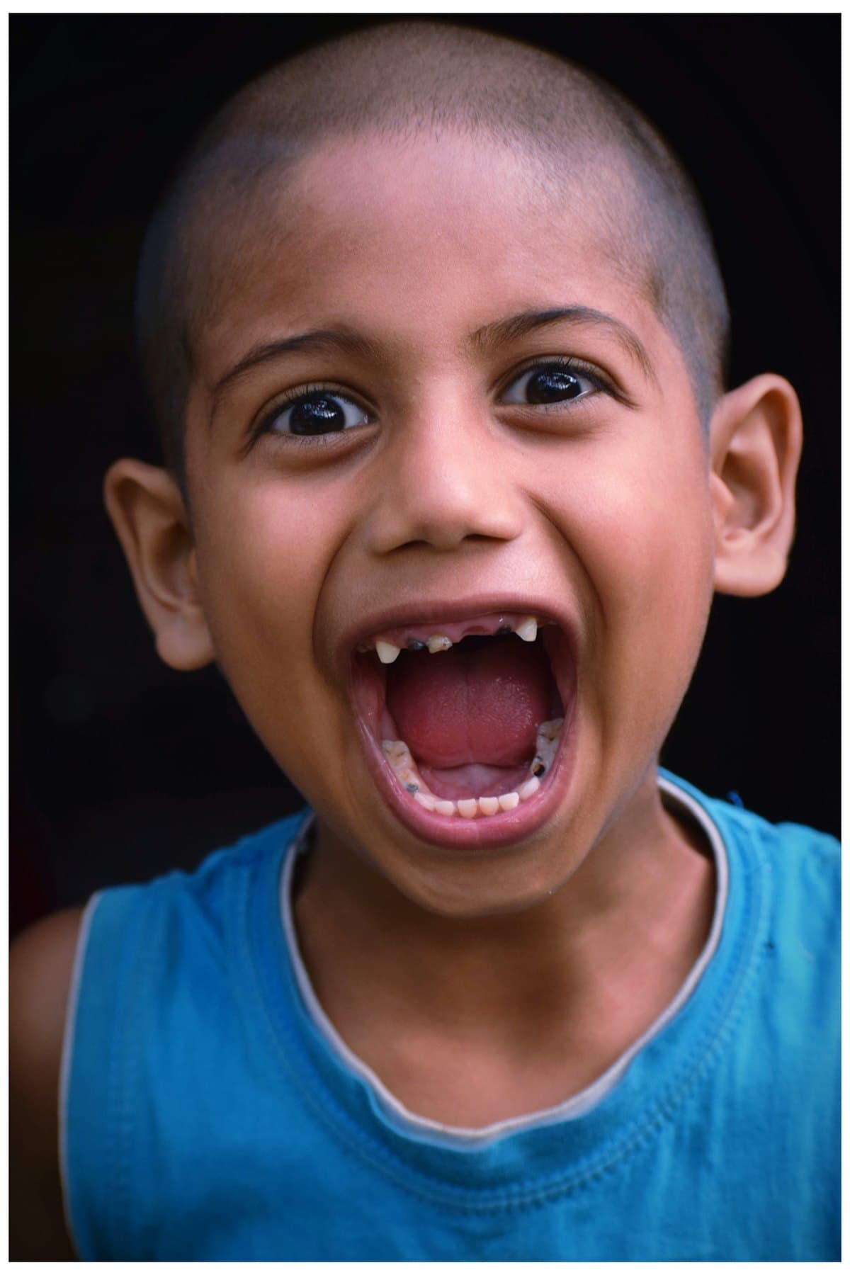 Selante dental em criança: por que aplicar nos molares?