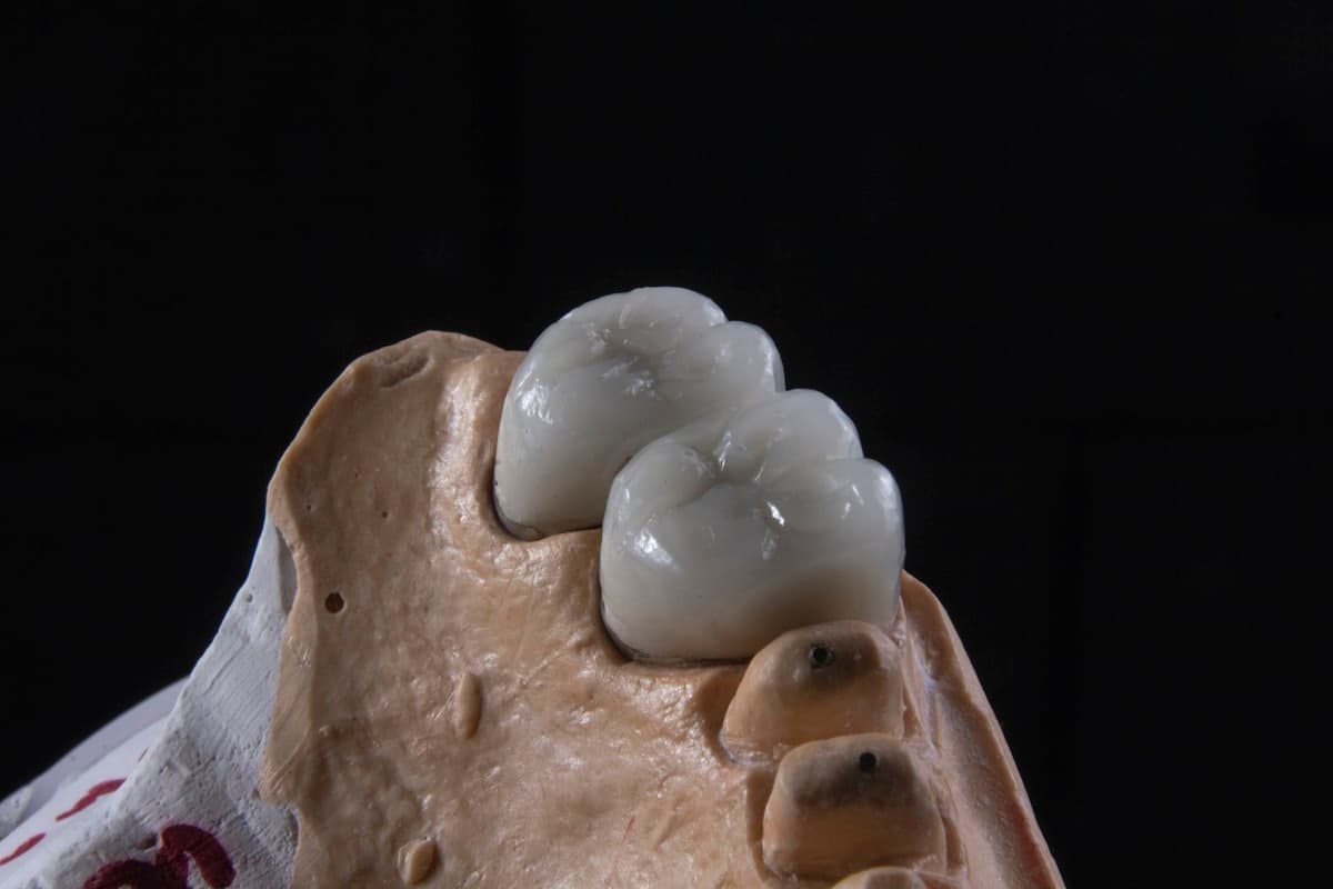 Cigarro e saúde bucal: o que o tabaco faz com seus dentes